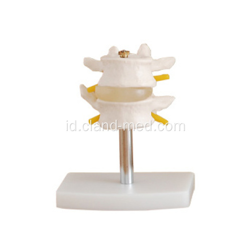 Model Lumbar Medis (2 pcs)